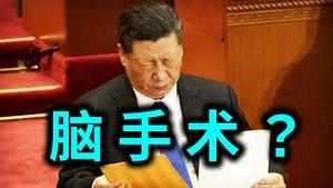 惊传！习近平将动脑手术？刘鹤表现异常。张展威武不屈，胡锡进跪献理论